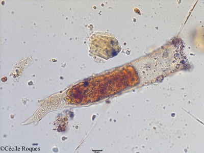 protozoo/Tintinnopsis corniger (1)(copy)_thumb.jpg